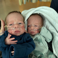 Two young babies with oxygen tubes